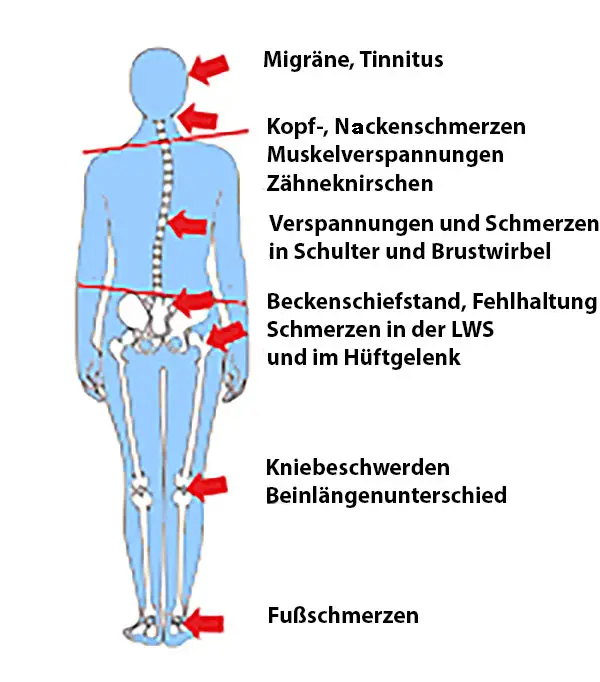 Symptome bei CMD